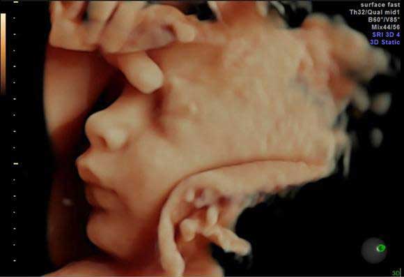 HDlive ultrasound płodu – realistyczny widok całego ciała dziecka