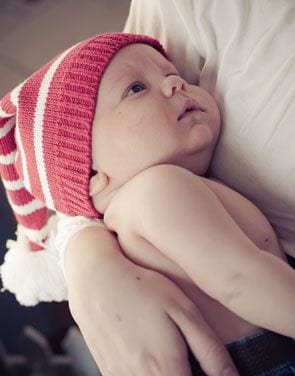 Dzieci z AZS - jak pielęgnować ich skórę? 43 atopowe zapalenie skory u n