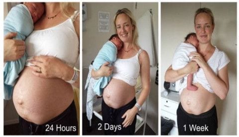 ciało po ciąży i porodzie