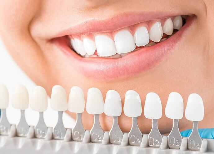 Jaką metodą wybielać zęby 6 Teeth whitening
